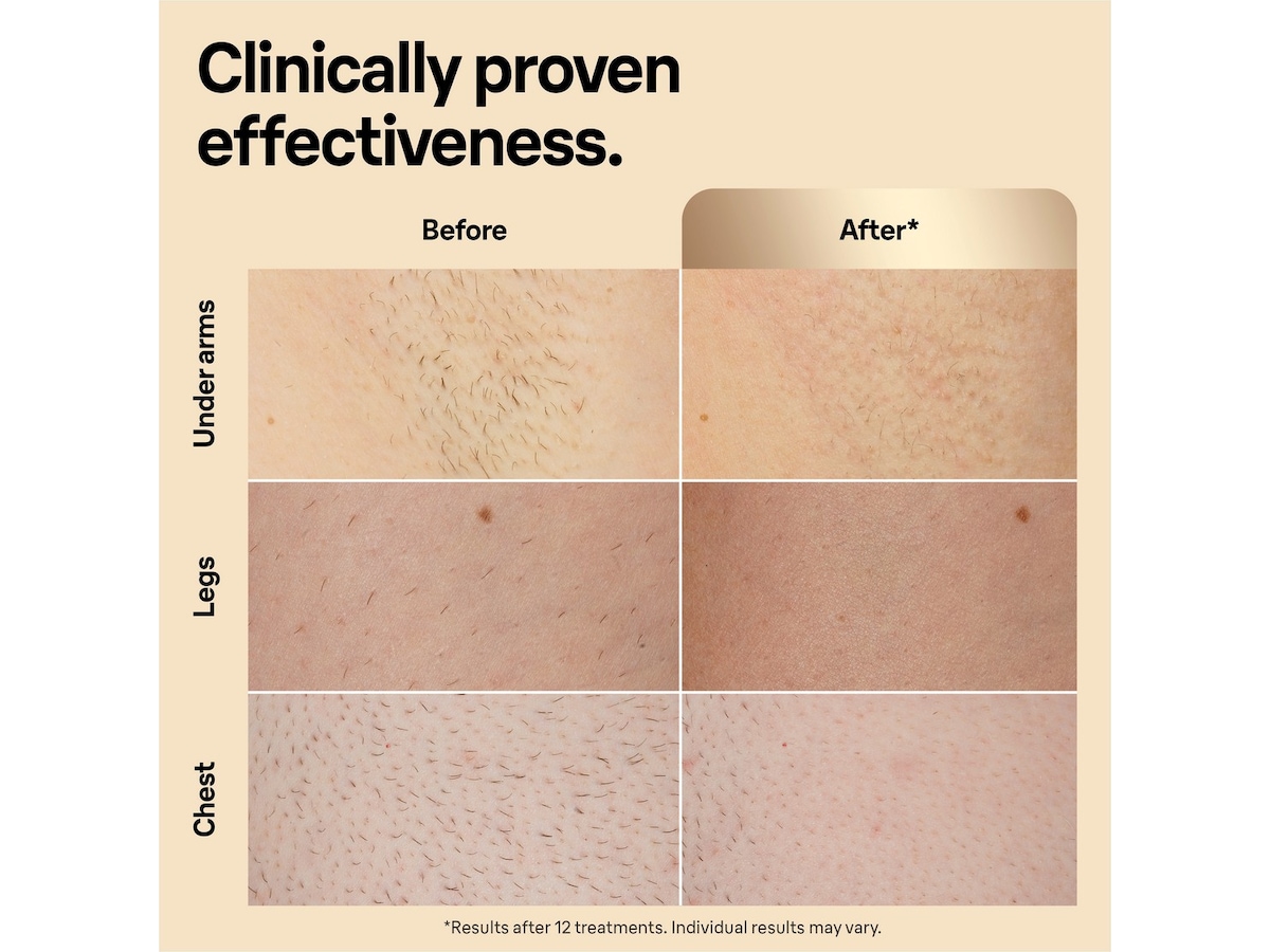 Braun IPL Silk·expert Pro 5 PL5242 (hvid/guld) Epilator & IPL-hårfjerning