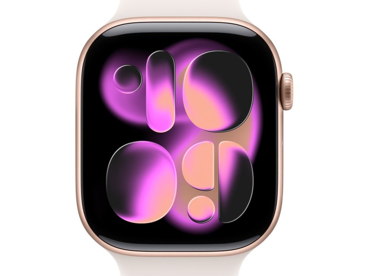 Apple Watch Series 11 GPS + LTE 46mm Aluminium (rosaguld) Smartwatches