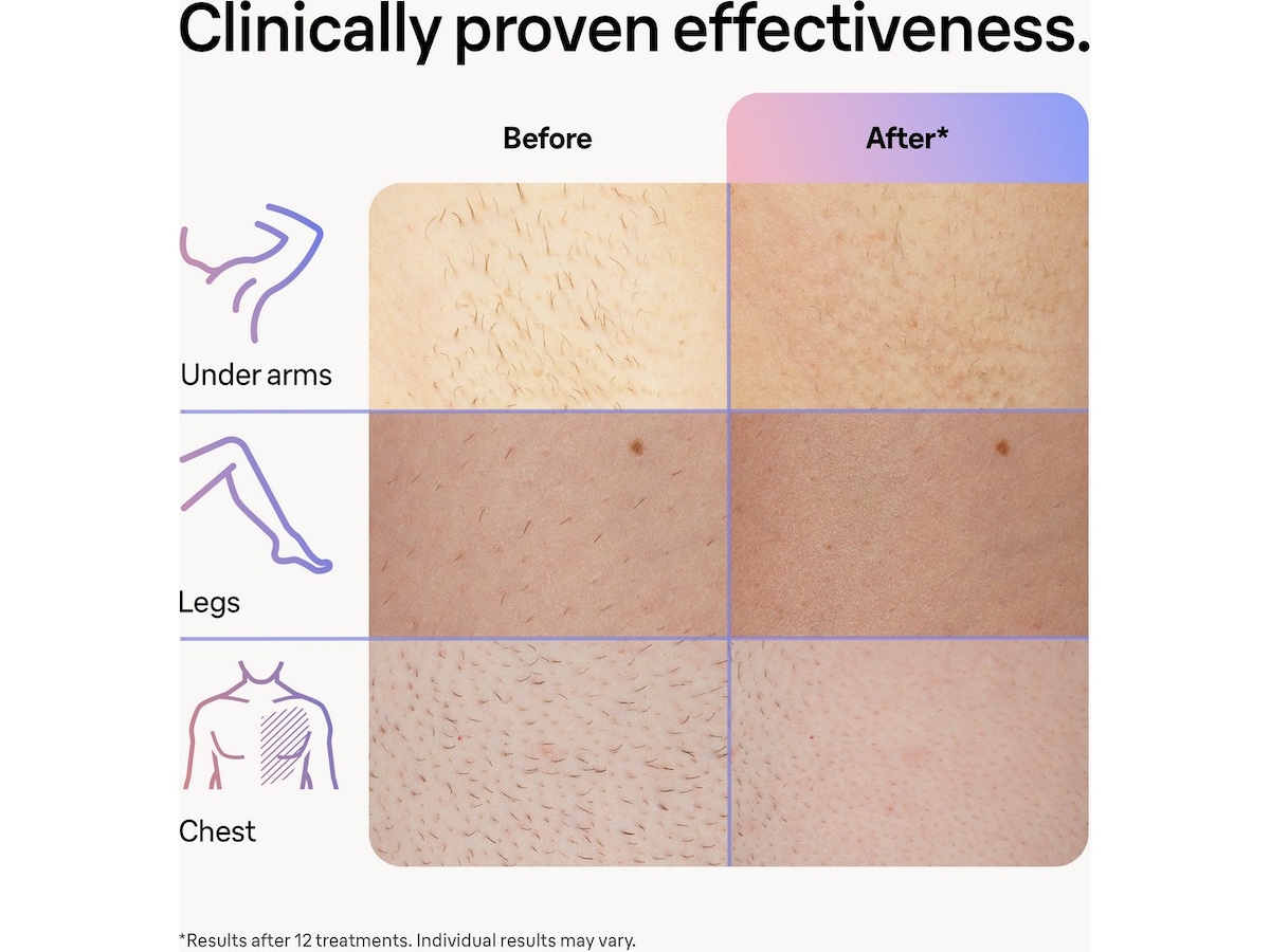 Braun Smart IPL Skin i·expert PL7253 (pink) Epilator & IPL-hårfjerning