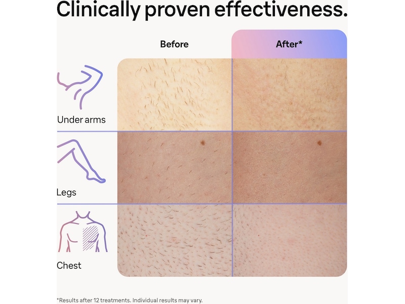 Braun Smart IPL Skin i·expert PL7253 (pink) Epilator & IPL-hårfjerning