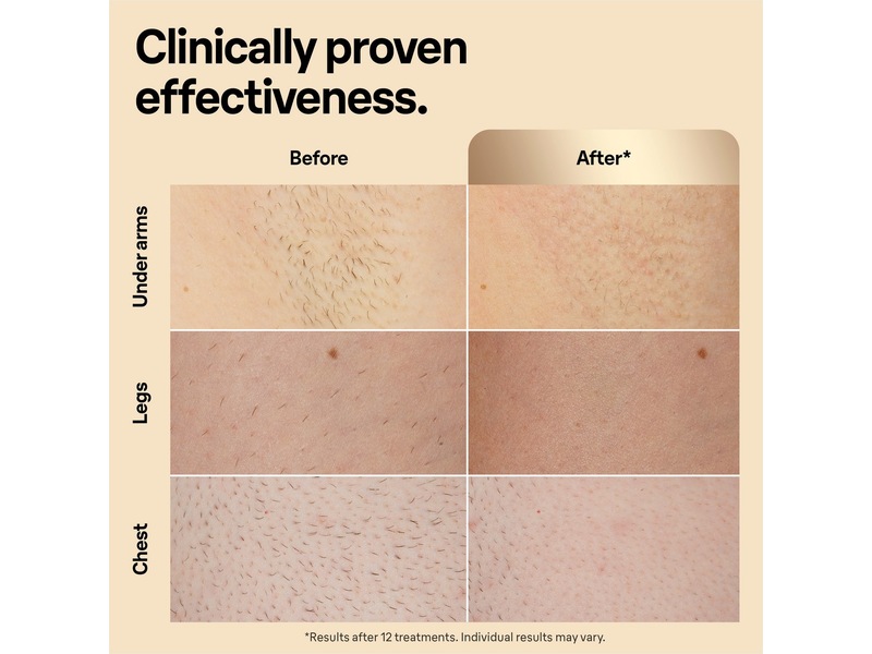 Braun IPL Silk·expert Pro 5 PL5242 (hvid/guld) Epilator & IPL-hårfjerning