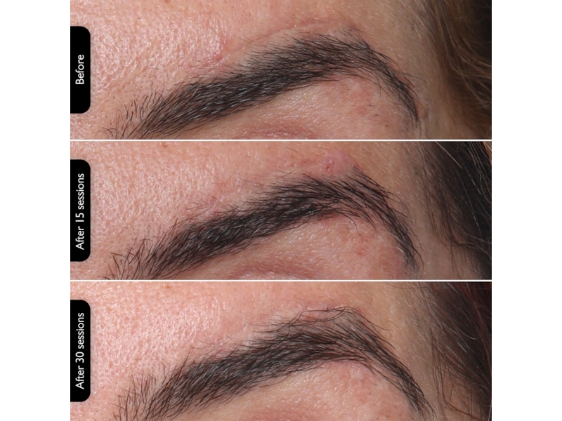 Silk'n Facial LED Mask Ansigtspleje